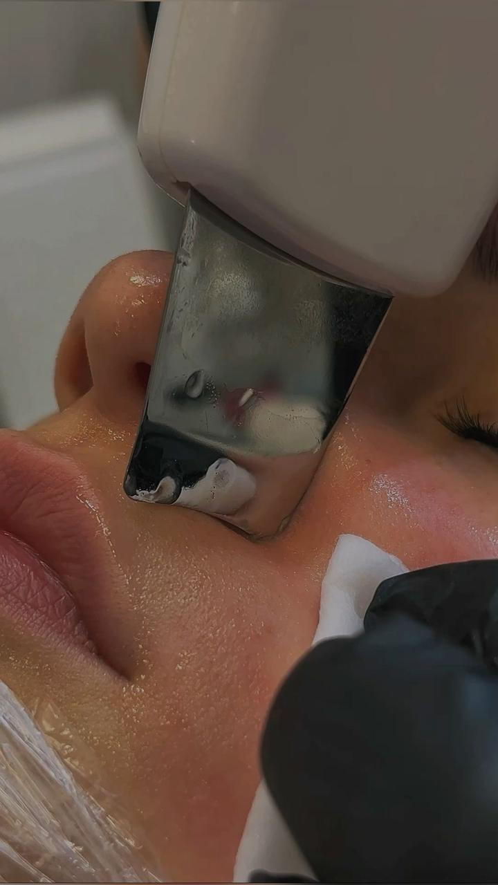 Soin du visage résultat 2