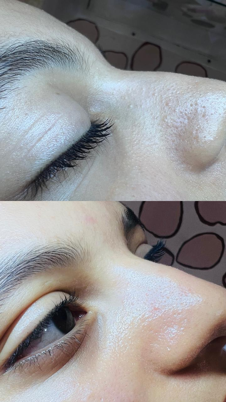 Soin du visage résultat 3
