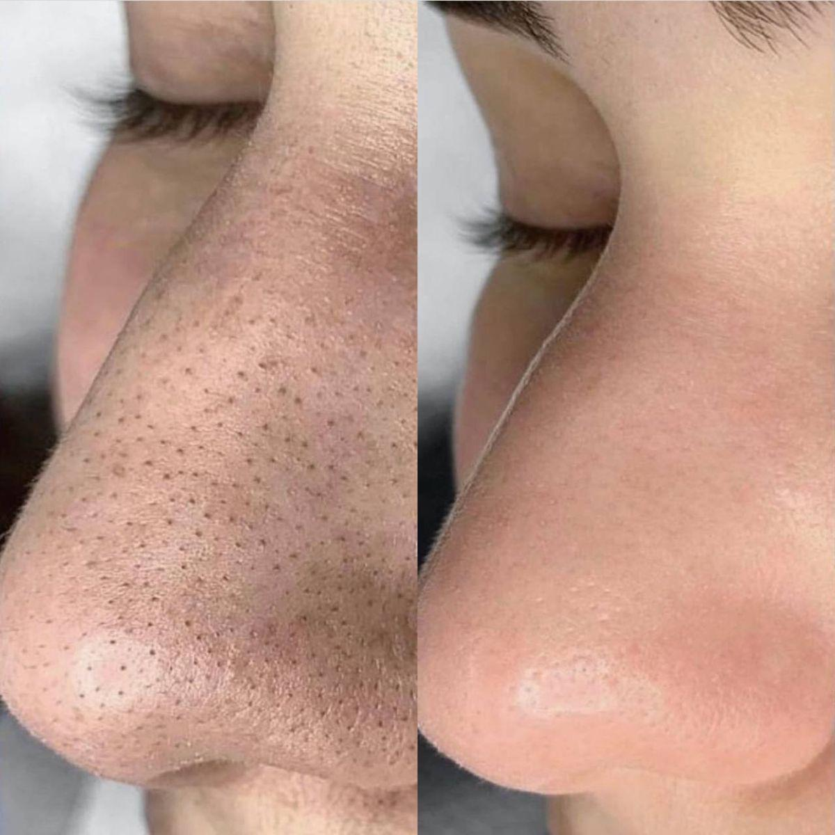 Soin du visage résultat 4